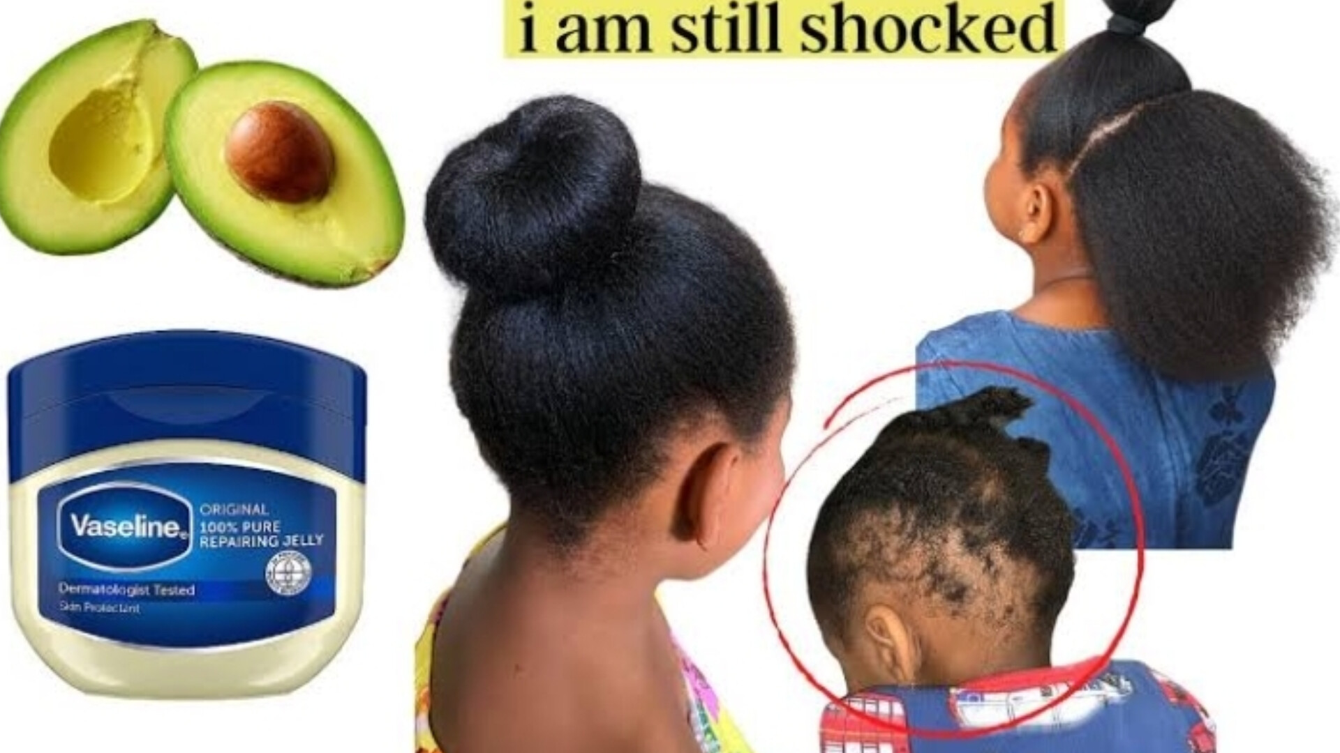 How To Use Avocado And Vaseline For Hair Growth And Thickness