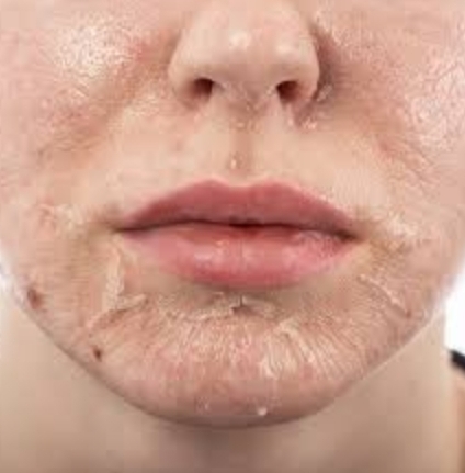 How To Get Rid Of Dark Spots On The Face 